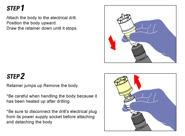 Body Removal